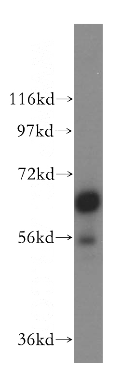 HeLa cells were subjected to SDS PAGE followed by western blot with Catalog No:116309(TRIM29 antibody) at dilution of 1:500