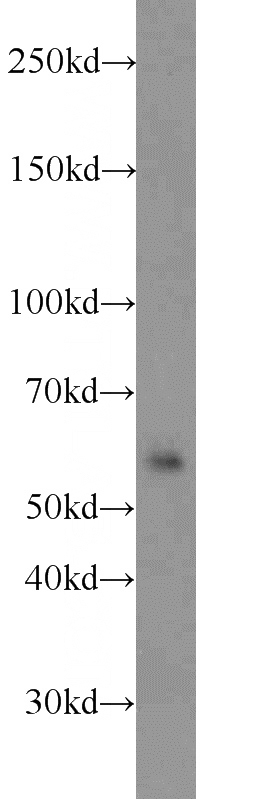 Jurkat cells were subjected to SDS PAGE followed by western blot with Catalog No:116308(TRIM27 antibody) at dilution of 1:1000