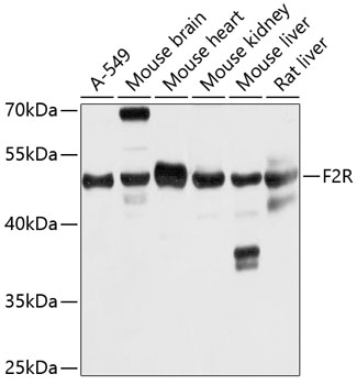 Western blot - F2R Polyclonal Antibody 