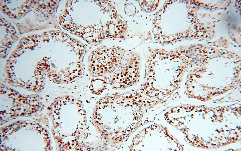 Immunohistochemical of paraffin-embedded human testis using Catalog No:114610(RBM3 antibody) at dilution of 1:50 (under 10x lens)