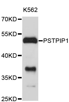 Western blot - PSTPIP1 Polyclonal Antibody 