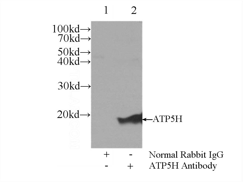 IP Result of anti-ATP5H (IP:Catalog No:108355, 3ug; Detection:Catalog No:108355 1:2000) with mouse liver tissue lysate 6000ug.