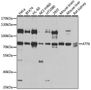 Western blot - ATF6 Polyclonal Antibody 