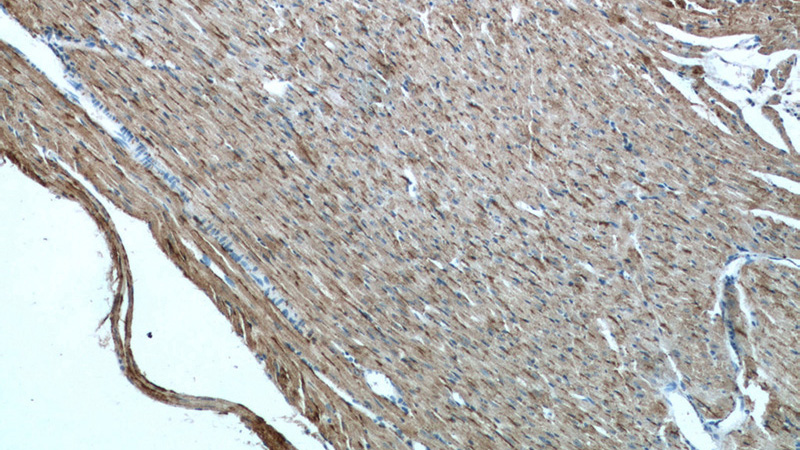 Immunohistochemistry of paraffin-embedded mouse heart tissue slide using Catalog No:113628(PD-L1/CD274 Antibody) at dilution of 1:50 (under 10x lens)