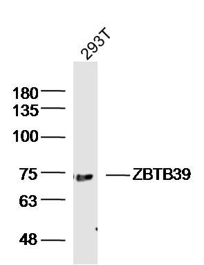 Fig1: Sample: 293T (human)cell Lysate at 40 ug; Primary: Anti-ZBTB39 at 1/300 dilution; Secondary: IRDye800CW Goat Anti-RabbitIgG at 1/20000 dilution; Predicted band size: 79 kD; Observed band size: 75 kD