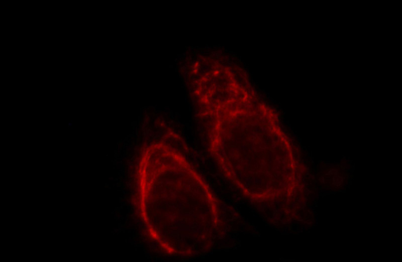 Immunofluorescent analysis of HepG2 cells, using KRT81 antibody Catalog No:112136 at 1:25 dilution and Rhodamine-labeled goat anti-rabbit IgG (red).