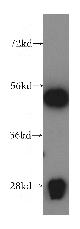 HepG2 cells were subjected to SDS PAGE followed by western blot with Catalog No:116413(WARS antibody) at dilution of 1:500