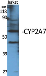 Fig1:; Western Blot analysis of various cells using CYP2A7 Polyclonal Antibody diluted at 1: 2000