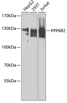 Western blot - PPP6R2 Polyclonal Antibody 