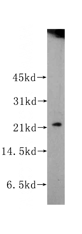 BxPC-3 cells were subjected to SDS PAGE followed by western blot with Catalog No:114420(RAB22A antibody) at dilution of 1:400