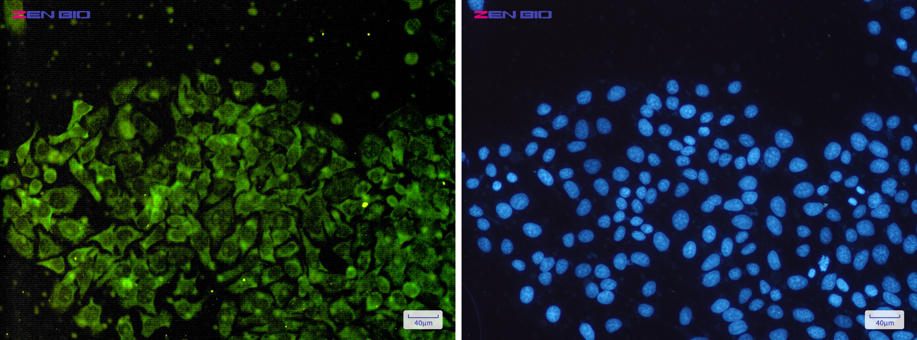 Immunocytochemistry of NSE(green) in Hela cells using NSE Rabbit pAb at dilution 1/50, and DAPI(blue)