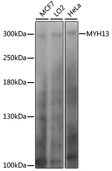 Western blot - MYH13 Polyclonal Antibody 