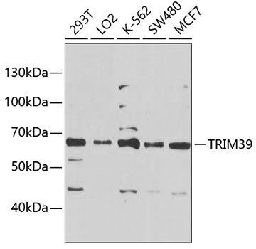 Western blot - TRIM39 Polyclonal Antibody 