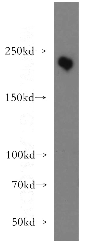 L02 cells were subjected to SDS PAGE followed by western blot with Catalog No:112986(MYO7A antibody) at dilution of 1:500