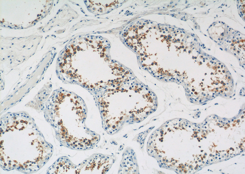 Immunohistochemistry of paraffin-embedded human testis tissue slide using Catalog No:115955(TEX101 Antibody) at dilution of 1:50 (under 10x lens)