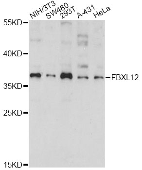 Western blot - FBXL12 Polyclonal Antibody 