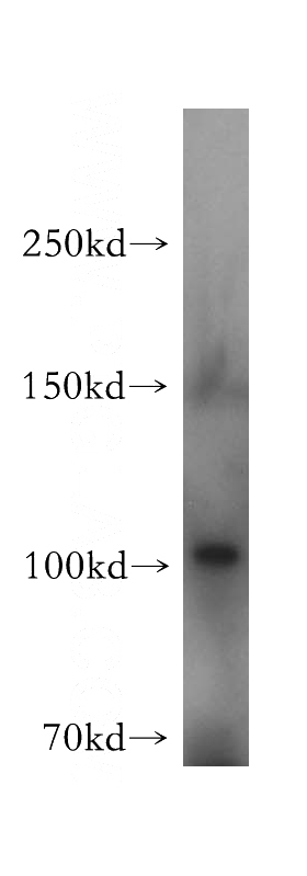 mouse liver tissue were subjected to SDS PAGE followed by western blot with Catalog No:112564(MCTP2 antibody) at dilution of 1:500
