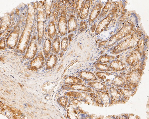 Fig3:; Immunohistochemical analysis of paraffin-embedded rat large intestine tissue using anti-TMEM163 antibody. The section was pre-treated using heat mediated antigen retrieval with Tris-EDTA buffer (pH 8.0-8.4) for 20 minutes.The tissues were blocked in 5% BSA for 30 minutes at room temperature, washed with ddH; 2; O and PBS, and then probed with the primary antibody ( 1/50) for 30 minutes at room temperature. The detection was performed using an HRP conjugated compact polymer system. DAB was used as the chromogen. Tissues were counterstained with hematoxylin and mounted with DPX.
