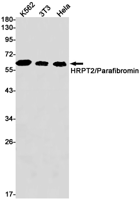 Western blot detection of HPRT in K562,3T3,Hela cell lysates using HPRT Rabbit pAb(1:1000 diluted).Predicted band size:25kDa.Observed band size:25kDa.