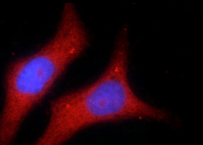Immunofluorescent analysis of HepG2 cells using Catalog No:114715(RIPK1-Specific Antibody) at dilution of 1:25 and Rhodamine-Goat anti-Rabbit IgG