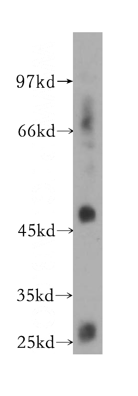 human heart tissue were subjected to SDS PAGE followed by western blot with Catalog No:111112(GPR137B antibody) at dilution of 1:300