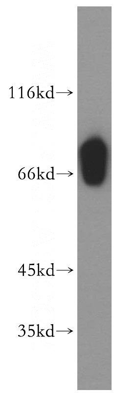human testis tissue were subjected to SDS PAGE followed by western blot with Catalog No:115363(SLC27A3 antibody) at dilution of 1:500