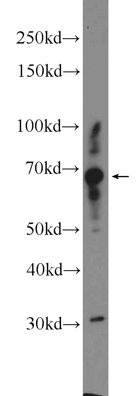 mouse embryo tissue were subjected to SDS PAGE followed by western blot with Catalog No:109517(CPNE5 Antibody) at dilution of 1:300