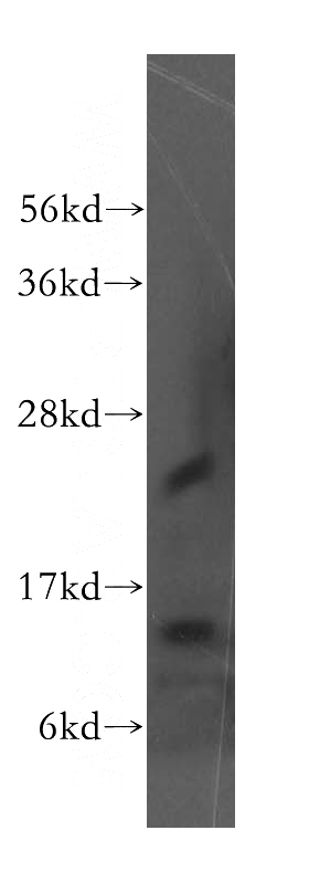 mouse liver tissue were subjected to SDS PAGE followed by western blot with Catalog No:110493(Evi2a antibody) at dilution of 1:300