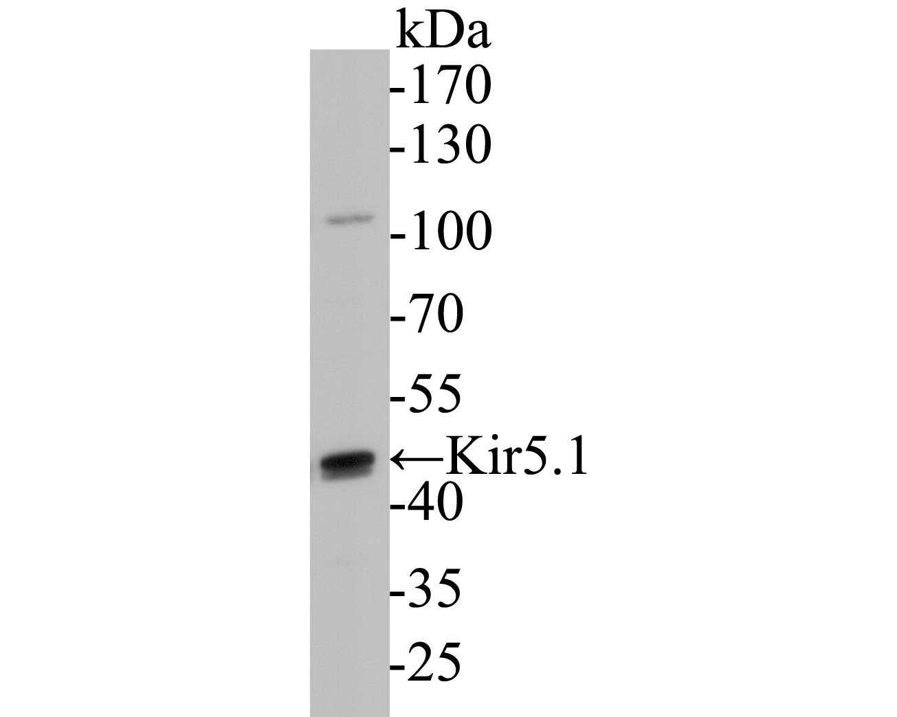Fig1: Western blot analysis of Kir5.1 on mouse kidney tissue lysate. Proteins were transferred to a PVDF membrane and blocked with 5% BSA in PBS for 1 hour at room temperature. The primary antibody ( 1/2000) was used in 5% BSA at room temperature for 2 hours. Goat Anti-Rabbit IgG - HRP Secondary Antibody (HA1001) at 1:5,000 dilution was used for 1 hour at room temperature.