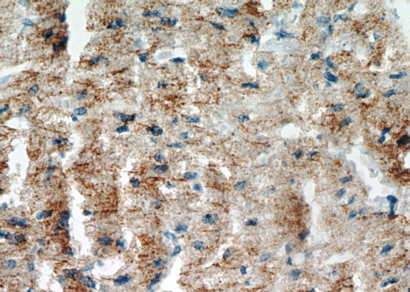 Immunohistochemical of paraffin-embedded human heart using Catalog No:115191(SH3D19 antibody) at dilution of 1:50 (under 40x lens)