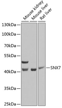 Western blot - SNX7 Polyclonal Antibody 