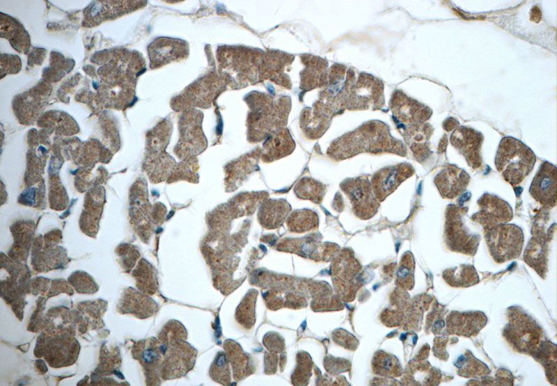 Immunohistochemistry of paraffin-embedded human heart slide using Catalog No:115484(SNX6 Antibody) at dilution of 1:50 (under 40x lens)