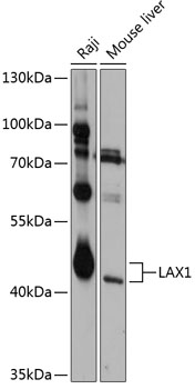 Western blot - LAX1 Polyclonal Antibody 
