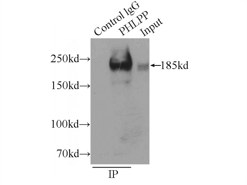 IP Result of anti-PHLPP (IP:Catalog No:113825, 5ug; Detection:Catalog No:113825 1:1000) with mouse brain tissue lysate 5000ug.
