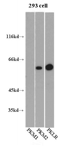 WB results of PKM1,PKM2,PKLR on 293 cell. (anti-PKM1 antibody is used as a negative control.)