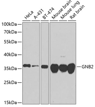 Western blot - GNB2 Polyclonal Antibody 