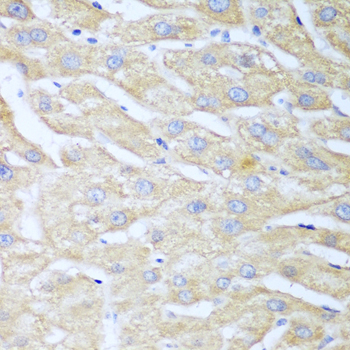 Immunohistochemistry - NUDT15 Polyclonal Antibody 