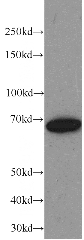human brain tissue were subjected to SDS PAGE followed by western blot with Catalog No:107641(TKT antibody) at dilution of 1:1000