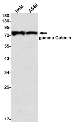 Western blot detection of gamma Catenin in Hela,A549 using gamma Catenin Rabbit mAb(1:1000 diluted)