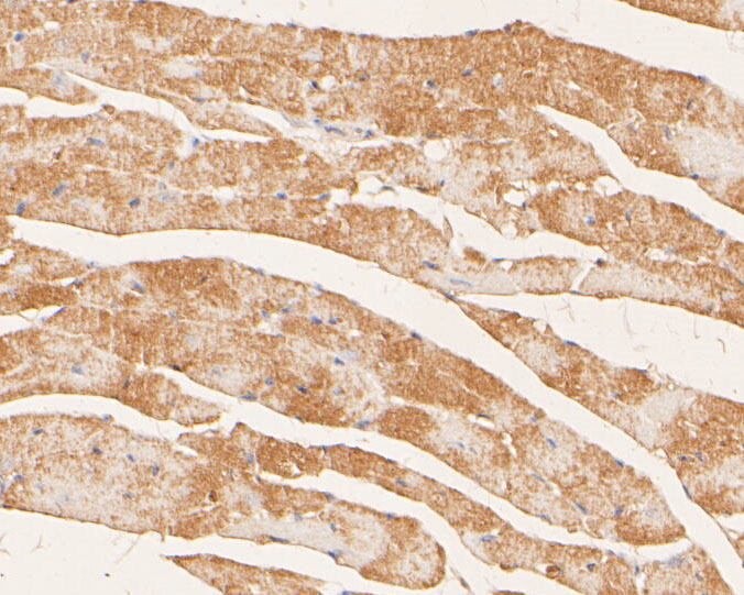 Fig3:; Immunohistochemical analysis of paraffin-embedded mouse heart tissue using anti-Myomegalin antibody. The section was pre-treated using heat mediated antigen retrieval with Tris-EDTA buffer (pH 8.0-8.4) for 20 minutes.The tissues were blocked in 5% BSA for 30 minutes at room temperature, washed with ddH; 2; O and PBS, and then probed with the primary antibody ( 1/100) for 30 minutes at room temperature. The detection was performed using an HRP conjugated compact polymer system. DAB was used as the chromogen. Tissues were counterstained with hematoxylin and mounted with DPX.