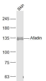 Fig2: Sample:; Skin (Rat) Lysate at 40 ug; Primary: Anti-Afadin at 1/1000 dilution; Secondary: IRDye800CW Goat Anti-Rabbit IgG at 1/20000 dilution; Predicted band size: 136 kD; Observed band size: 135/138 kD
