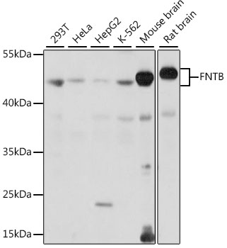 Western blot - FNTB Polyclonal Antibody 