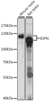 Western blot - ESPN Polyclonal Antibody 