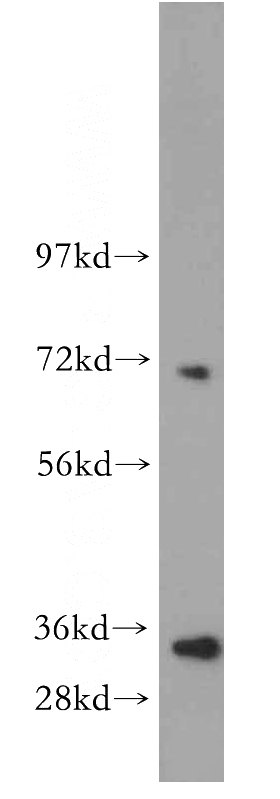 NIH/3T3 cells were subjected to SDS PAGE followed by western blot with Catalog No:114652(RHAMM,Lgals9 antibody) at dilution of 1:400