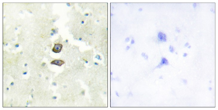 Fig2:; Immunohistochemistry analysis of paraffin-embedded human brain tissue, using BRI3B Antibody. The picture on the right is blocked with the synthesized peptide.