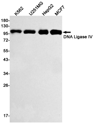 Western blot detection of DNA Ligase IV in K562,U251MG,HepG2,MCF7 cell lysates using DNA Ligase IV Rabbit mAb(1:500 diluted).Predicted band size:104kDa.Observed band size:104kDa.