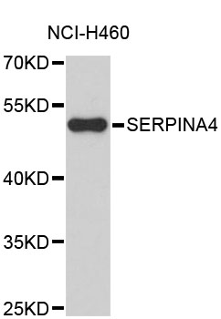 Western blot - SERPINA4 Polyclonal Antibody 