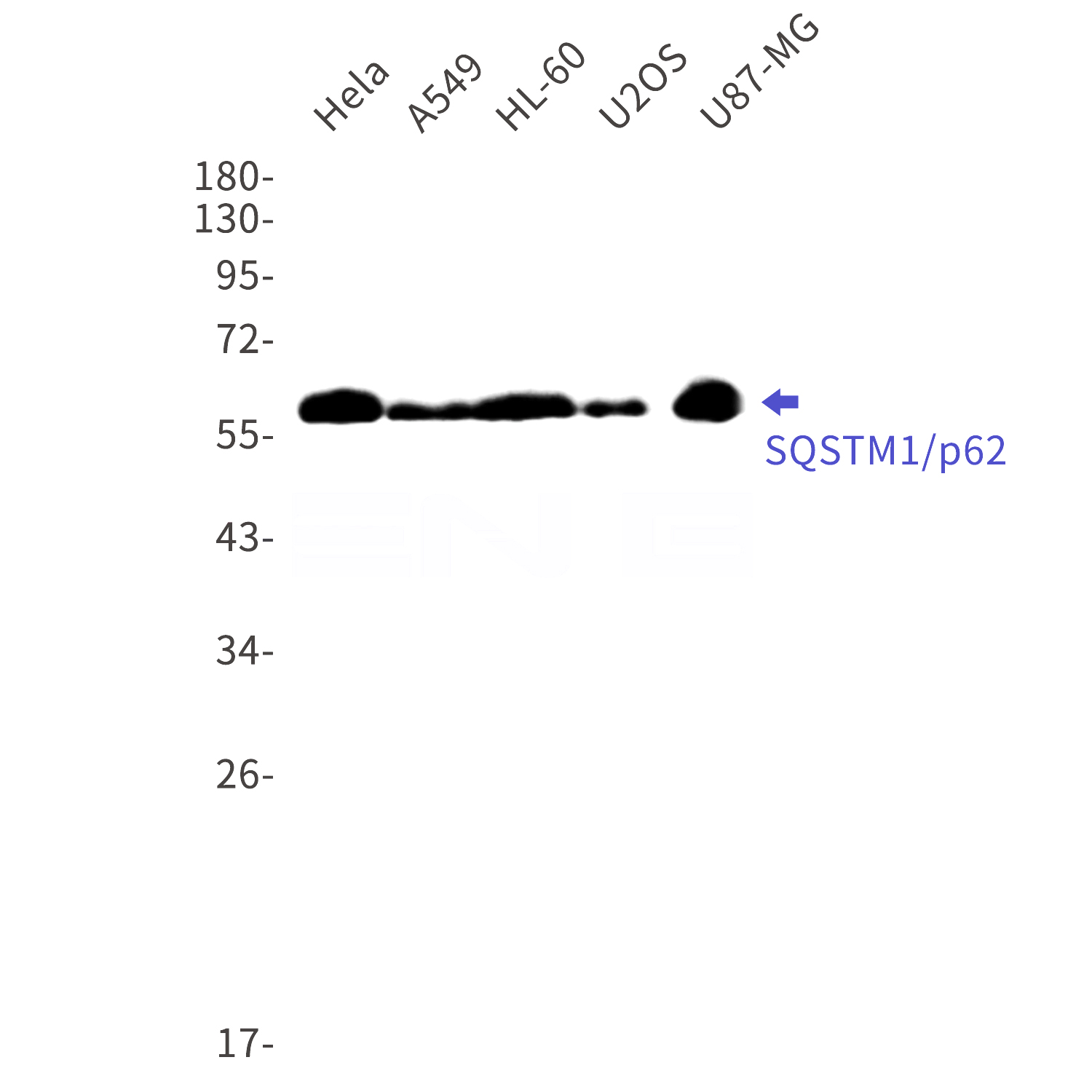 Western blot detection of SQSTM1/p62 in A549,HL-60,U2OS cell lysates using SQSTM1/p62 Rabbit mAb(1:1000 diluted).Predicted band size:48kDa.Observed band size:62kDa.