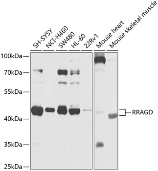 Western blot - RRAGD Polyclonal Antibody 