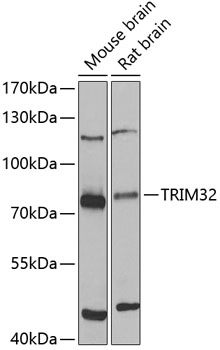 Western blot - TRIM32 Polyclonal Antibody 